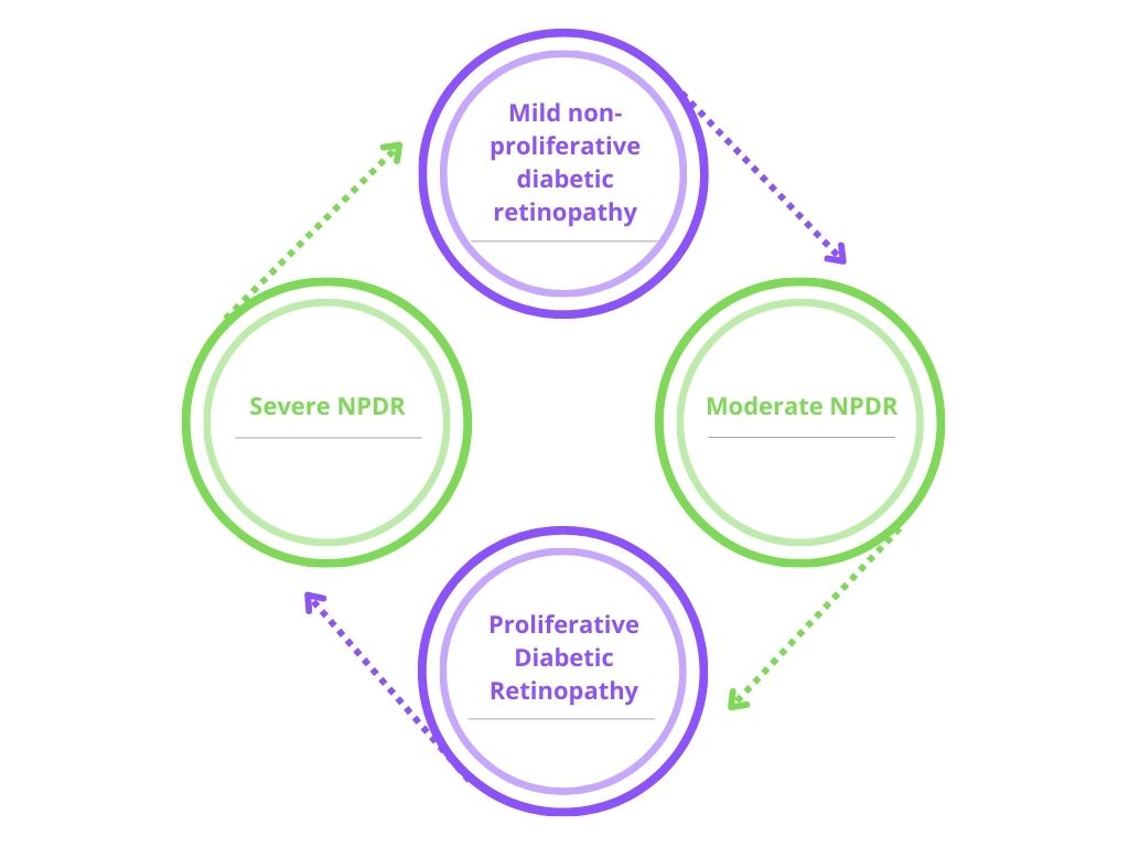 Stages of Diabetic Retinopathy